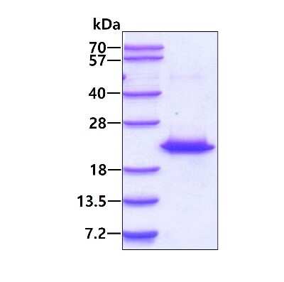 SDS-PAGE: Recombinant Human Centrin 2 His Protein [NBP1-50938]